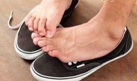 Itching is the cause of fungi