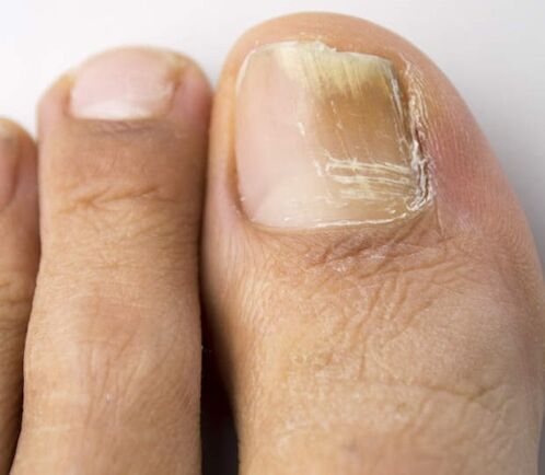 Use iodine to deal with faults