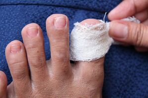 A sick nail