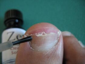 Apply varnish