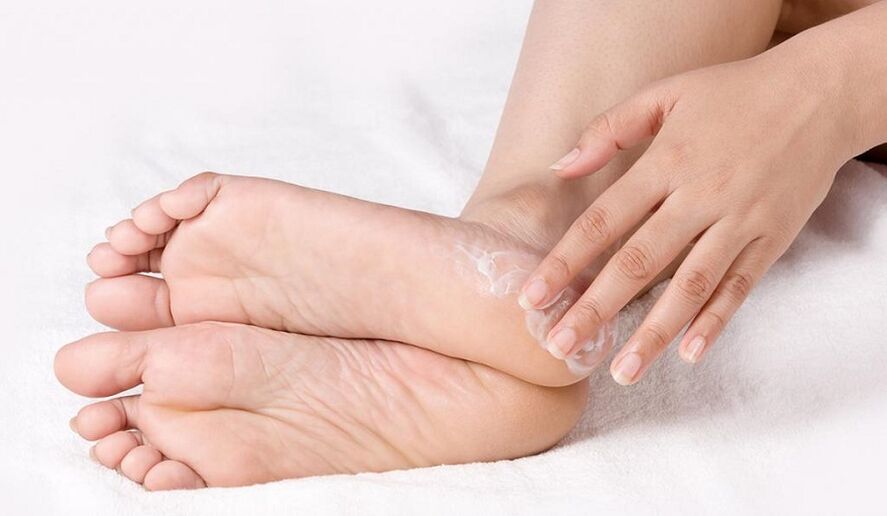 Treat foot fungus with ointments