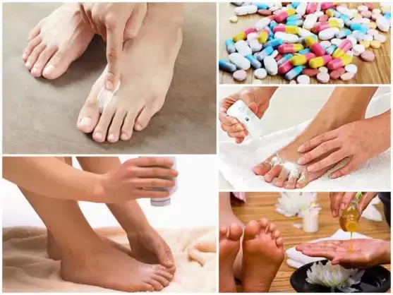 How to Treat Fungus Between Toes