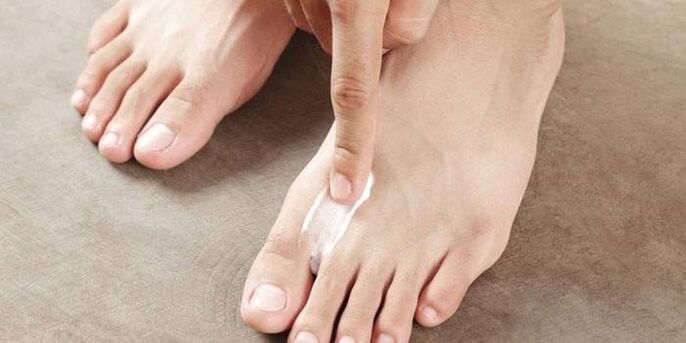 Ointment for treating fungus between toes