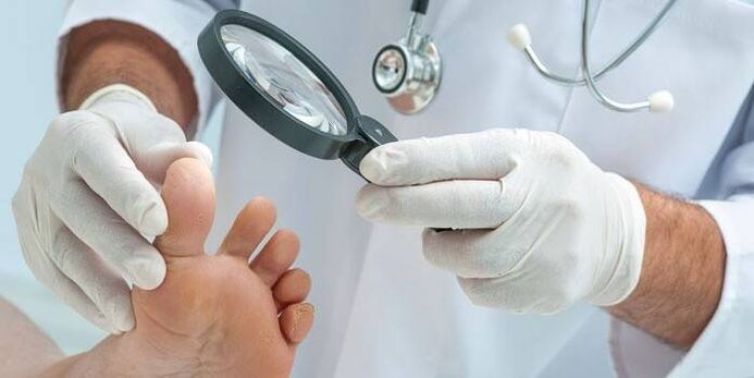 The doctor checks whether there is fungus between the toes