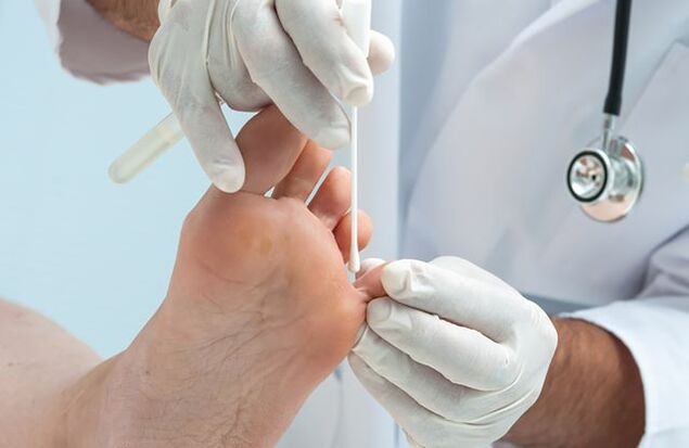 Diagnosis of toenail fungus