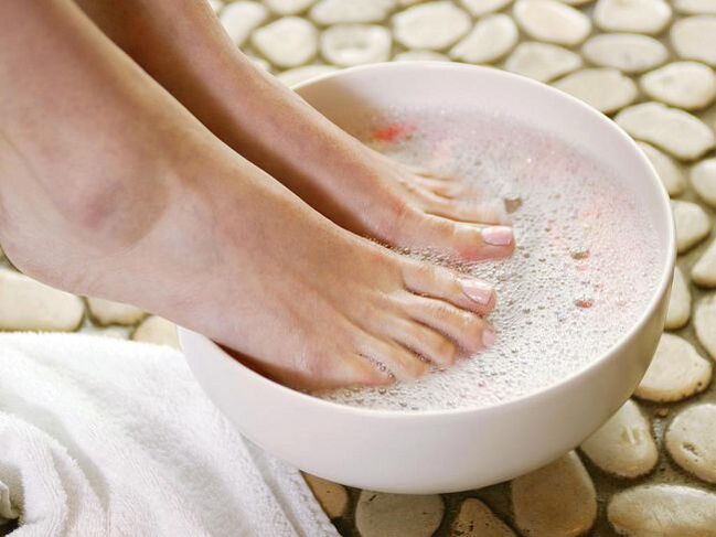 Vinegar baths are an effective way to treat onychomycosis